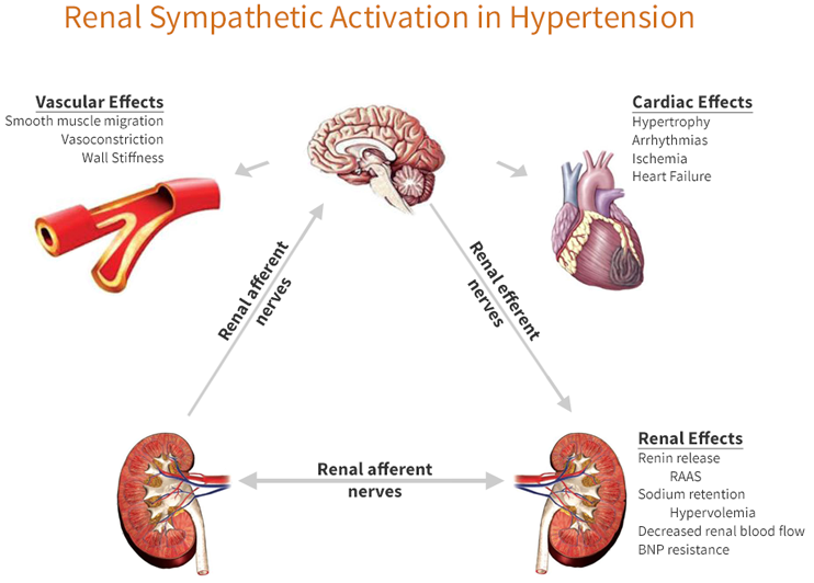 The Sympathetic Nervous System from Symple Surgical Inc.